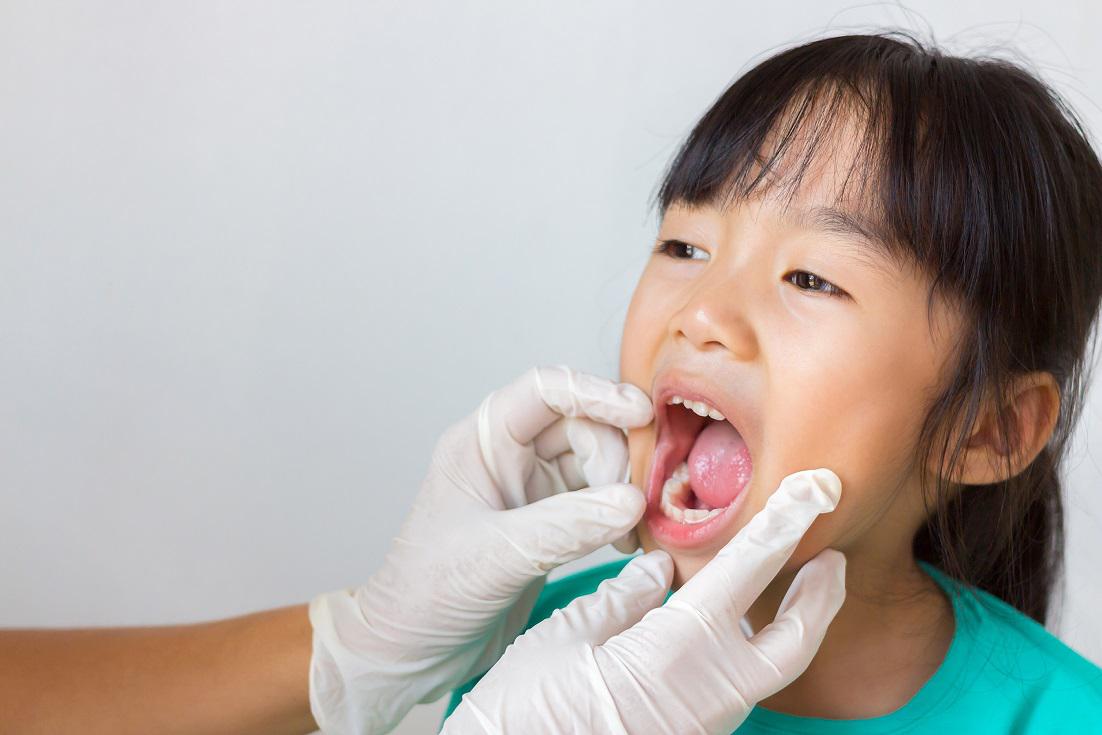 Signs Your Child’s Teeth Are Having Issues