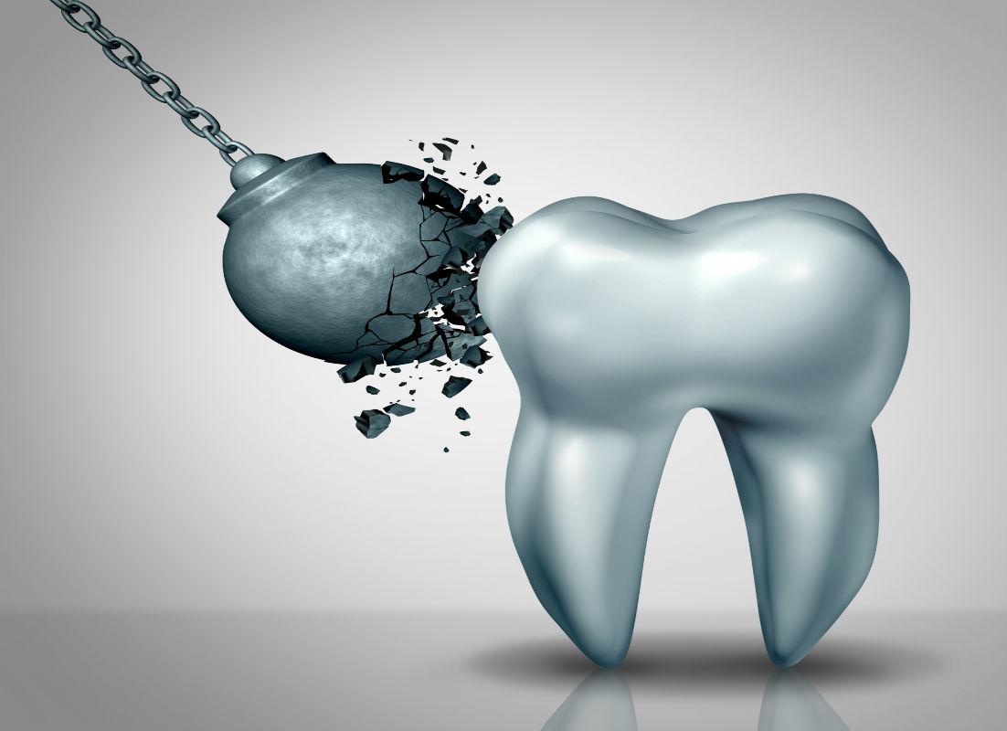 What is Tooth Enamel Erosion and Can It Be Treated?